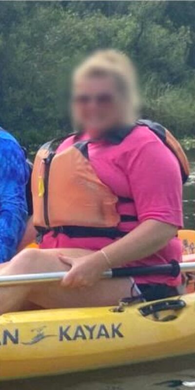 Before medical weight loss, Kim P., full length